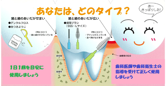 歯間清掃用具の選び方